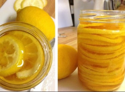 Régi német gyógymód az artériák megtisztítására!