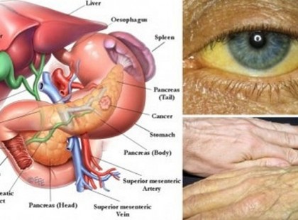 A HASNYÁLMIRIGYRÁK ELSŐ STÁDIUMÚ JELEI, AMIKRE ODA KELL FIGYELNED