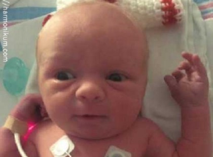 Az orvosok elkezdik a császármetszést. De mikor a baba megszületik, nem hisznek a szemüknek.