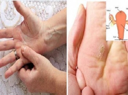 Hölgyek figyelem! 7 tünet, amely méhnyakrákra utalhat!