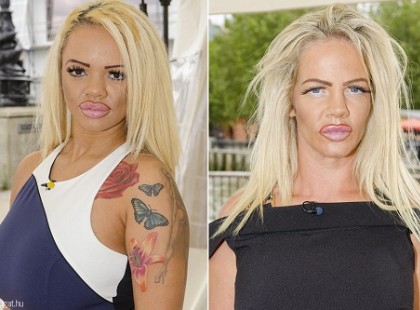 Az anya-lánya páros, akik 24 milliót költöttek plasztikára