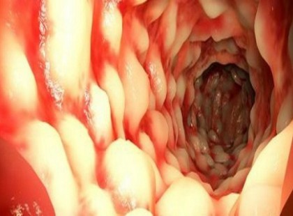 EDD EZT VACSORÁRA 3 NAPIG, NEM HISZED EL, MI TÁVOZIK A BELEIDBŐL!