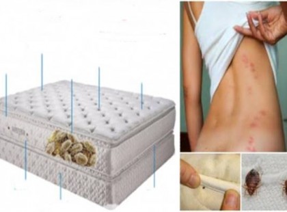 A matracodban élő baktériumok számos betegséget okozhatnak. Tudtad? Így szabadulj meg tőlük!