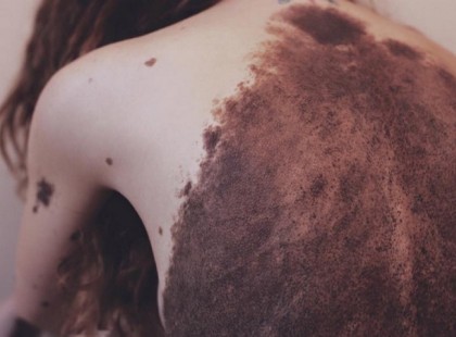 Az orvosok nem adtak esélyt a babának. De 26 évvel később felkavarja a dolgokat ezekkel fotókkal!