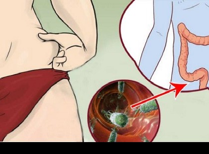 A hasháj kialakulásának 7 oka, amire nem figyelsz, és ami ellen nem teszel semmit!