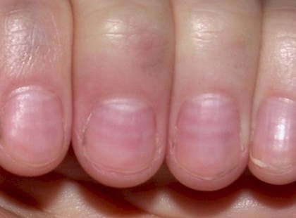 3 INTŐ JEL A KÖRMÖN, AMI VESZÉLYT JELEZ!