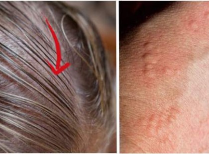 HA EZEKET A TÜNETEKET TAPASZTALOD, NEM MŰKÖDIK MEGFELELŐEN A PAJZSMIRIGYED!