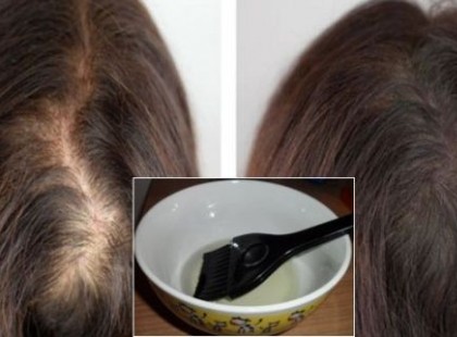 ÍGY SZÉPÜLTEM MEG A RICINUSOLAJ SEGÍTSÉGÉVEL: NŐ A HAJAM ÉS A SZEMPILLÁM, MINT A BOLONDGOMBA