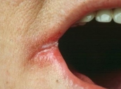 NE JÁTSSZ AZ ÉLETEDDEL! EZEKET A TÜNETEKET ÉSZLELTED? VALAMI NAGYON ROSSZRA UTALHATNAK!