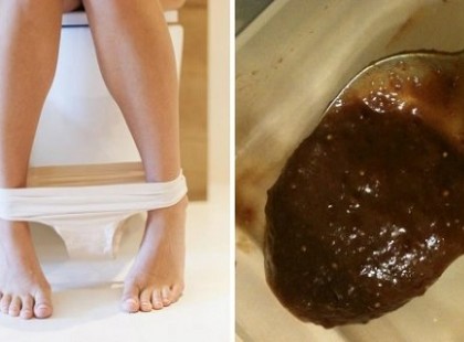 AZ ORVOSOK EZT A TERMÉSZETES HASHAJTÓT JAVASOLJÁK A BELEK TELJES KIÜRÍTÉSÉRE!