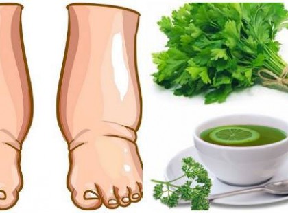 EZ A HATÉKONY, HÁZILAG ELKÉSZÍTHETŐ TEA NÉHÁNY NAP ALATT MEGGYÓGYÍTJA A LÁBDAGADÁST!