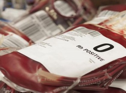 Ha nullás a vércsoportod, ezt el kell olvasnod az egészséged forog kockán!