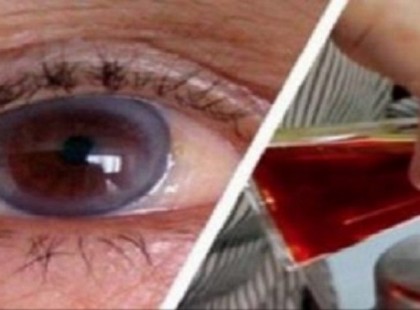 IDEJE ELDOBNI A SZEMÜVEGET, EZ A MÓDSZER 97%-AL JAVÍTJA A LÁTÁST!