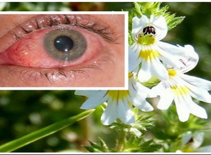 A növény, amely még 70 fölöttieknél is javítja a szemet, erősíti a látást, leviszi a szemnyomást