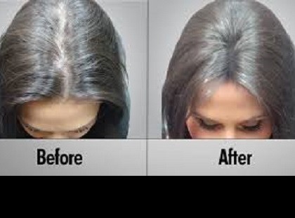 EZ A KÉT CSODANÖVÉNY MEGMENT A HAJHULLÁSTÓL, SŐT VISSZANÖVESZTI A HAJADAT!