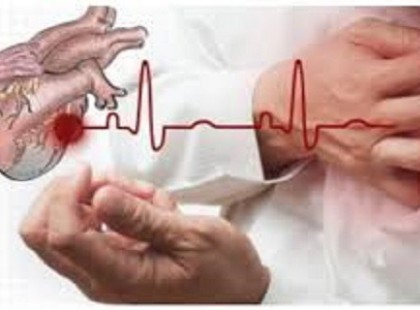 EZT TEDD, HA SZÍVROHAMOND VAN, MINDÖSSZE 10 MÁSODPERCED MARAD A CSELEKVÉSRE