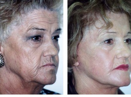 KÉSZÍTSD EL EZT AZ OTTHONI KRÉMET, ÉS A LEGMÉLYEBB RÁNCAID IS EL FOGNAK TŰNNI RÖVID IDŐ ALATT!