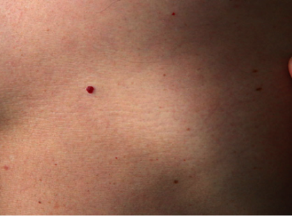 HA ILYEN ANYAJEGYED VAN, AZ AKÁR A RÁK JELE IS LEHET! NAGYON ODA KELL FIGYELNI!