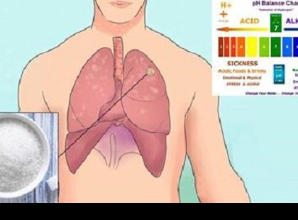 MINDENKINEK VANNAK RÁKOS SEJTEK A TESTÉBEN, MIT TEHETÜNK, HOGY NE ALAKULJON KI BELŐLÜK TUMOR?