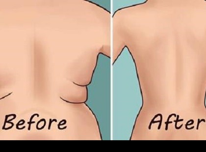 TÜNTESD EL A HÁJAT A HÁTADRÓL ÉS A HÓNALJBÓL EZZEL A 4 EGYSZERŰ GYAKORLATTAL