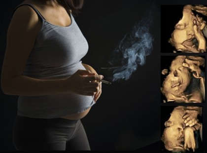 ÍGY NÉZNEK KI EGY DOHÁNYZÓ KISMAMA ULTRAHANGOS KÉPEI...