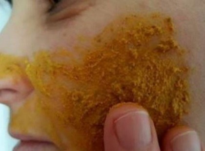 KURKUMÁT DÖRZSÖLT AZ ARCÁRA, AZTÁN, AMIKOR LEMOSTA... WOW!