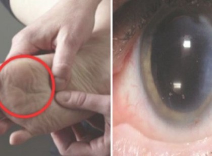 NE LEGYINTS RÁ! HA EZT ÉSZLELED A LÁBADON, NAGY LEHET A BAJ!