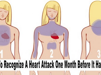 A SZÍVINFARKTUS EGY HÓNAPPAL A MEGTÖRTÉNÉSE ELŐTT FELISMERHETŐ!