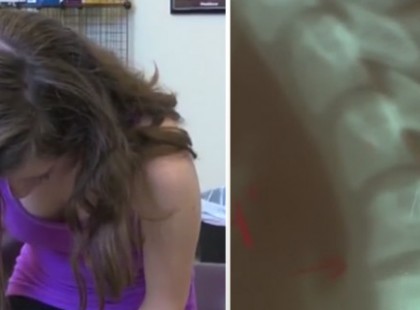 A LÁNYNAK CSUPÁN FÁJT A NYAKA. NEM FOGOD ELHINNI A DIAGNÓZIST!