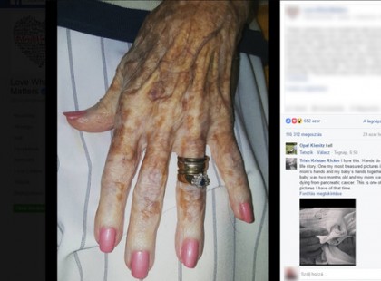 AZ IDŐS HÖLGY NEM AKARTA FELHÍVNI A FIGYELMET A KEZÉRE, MERT SZÉGYELLTE... AZTÁN A FIATAL LÁNY EZT MONDTA NEKI!