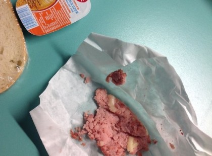 EZT KELL ENNIÜK AZ EMBEREKNEK A MAGYAR KÓRHÁZAKBAN!