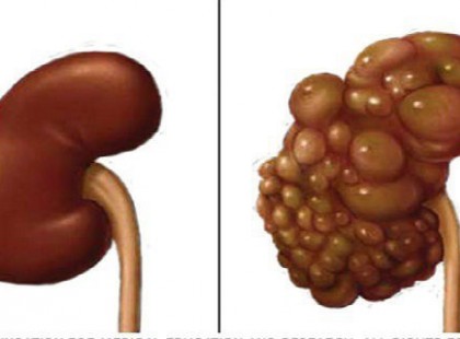 HA MEG AKAROD VÉDENI A VESÉIDET, EZT NE TEDD!