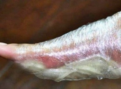 A betegségek a talpadon keresztül távoznak: ezt a szívességet meg kell tenned a testednek!