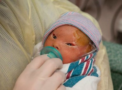 Édesanyja rettenetesen megijedt, mikor meglátta újszülött babáját. Most mindenkinek elmondja történetét.