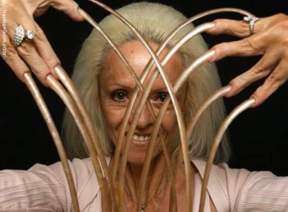 A körmei jelentették neki a világot, amíg ez történt