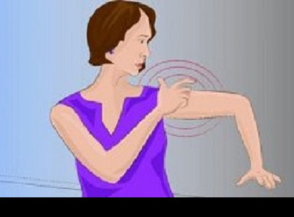 AZ AGYVÉRZÉS ELŐTT EGY HÓNAPPAL EZEKET A JELEKET KÜLDI A TESTED! NAGYON FIGYELJ!