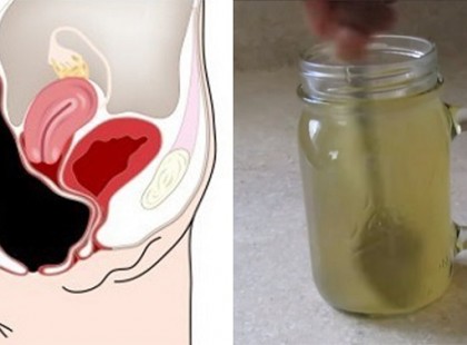 EZ AZ EGYSZERŰ ITAL KÉPES TÖBB KILÓ MÉREGANYAGOT ELTÁVOLÍTANI A VASTAGBÉLBŐL!