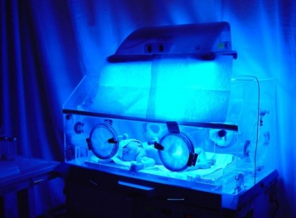 A halva született kislány 8 perc után életre kelt és jégbe tették! Ma már nagyszerűen érzi magát!