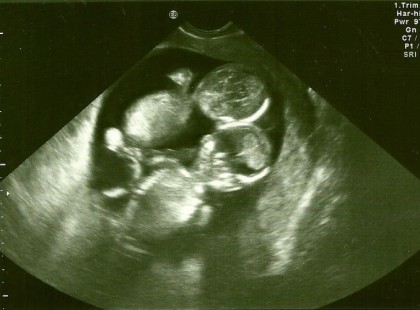 Az orvos azt mondta neki, hogy tartsa a terhességét titokban, mert a baba meg is halhat. Mi történik ezután? Azta!