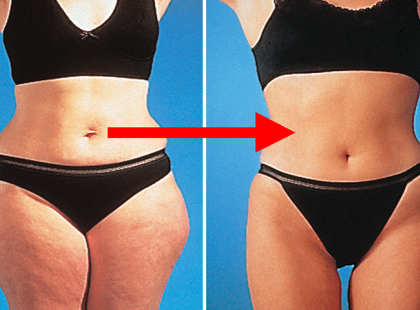 Idd ezt és fogy heti 3 kilót, diéta és edzés nélkül!