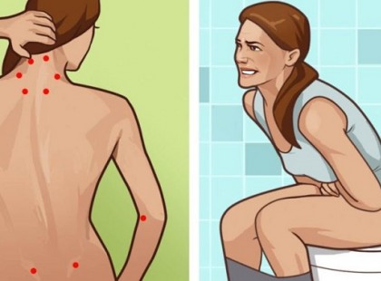 MI IS A FIBROMYALGIA? OKOK, TÜNETEK, KEZELÉSI LEHETŐSÉGEK