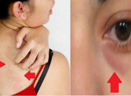 8 RIASZTÓ JEL, HOGY TÚL SOK CUKOR VAN A TESTEDBEN