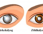 Csoda helyett: ez a hétköznapi fűszernövény számos szembetegségen segíthet!
