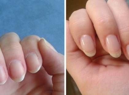 Nem kell többé drága műköröm! Ezzel a módszerrel nem törik be a körmöd!