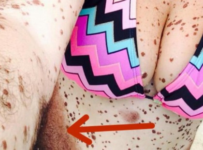 Ez a 19 éves lány megosztott néhány bikinis képet. De ami a köldöke és a combjai között nő, fejek fordulnak meg utána.