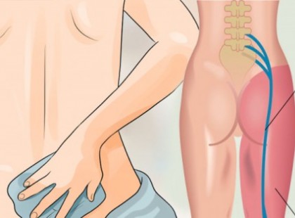 GYÓGYMÓD ISIÁSZOS FÁJDALOM ELLEN, AMIT KI KELL PRÓBÁLNOD, MIELŐTT MÉG EGY FÁJDALOMCSILLAPÍTÓT BEVENNÉL!