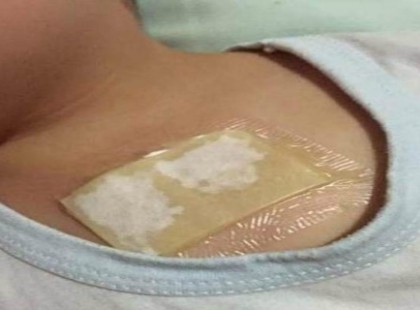 KÉSZÍTSD EL EZT A GYÖMBÉRES BOROGATÁST! EGYETLEN ÉJSZAKA MEGGYÓGYÍTJA A LÉGZŐSZERVI BETEGSÉGEKET