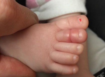 Ez a kisbaba nem hagyta abba a sírást. Aztán a szülei EZT fedezték fel a lábán. Mindenkinek tudnia kell erről a veszélyről!