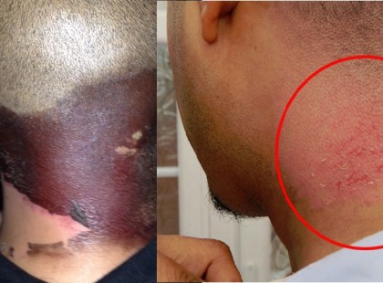 Ez a férfi az udvari szárítóról szedte össze a ruháit.majd a vállára tette őket, ám ekkor váratlanul óriási fájdalom árasztotta el az egész testét!