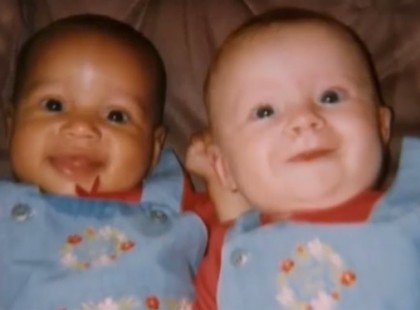 Az édesanya ikreket szül – élete legnagyobb megrázkódtatása az, mikor meglátja az arcukat